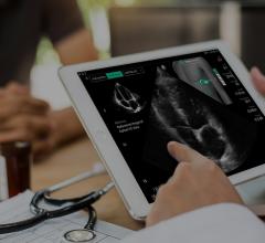 New Data Highlights Accuracy, Accessibility of AI-Guided Cardiac Imaging